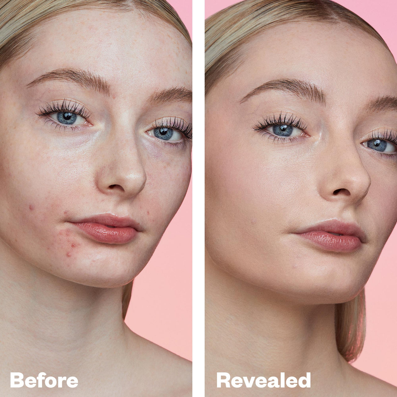 Skin improvements before and after wearing Kosas