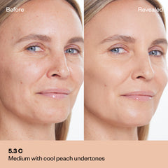 Shade 5.3 C: A "Before" and "Revealed" comparison of a model with a medium light complexion. The text labels the shade as Medium light with peach undertones.